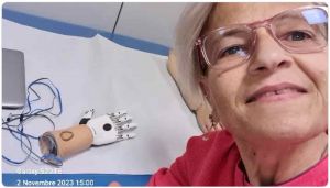 Il sogno di Cinzia una protesi al braccio che muova tutte le falangi. Servono 29mila euro, su GoFundMe la raccolta fondi