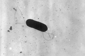 Cos'è il batterio Listeria monocytogenes