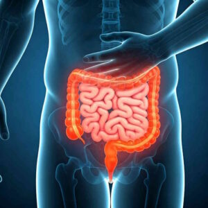 Sindrome del colon irritabile: quali sono le cause?